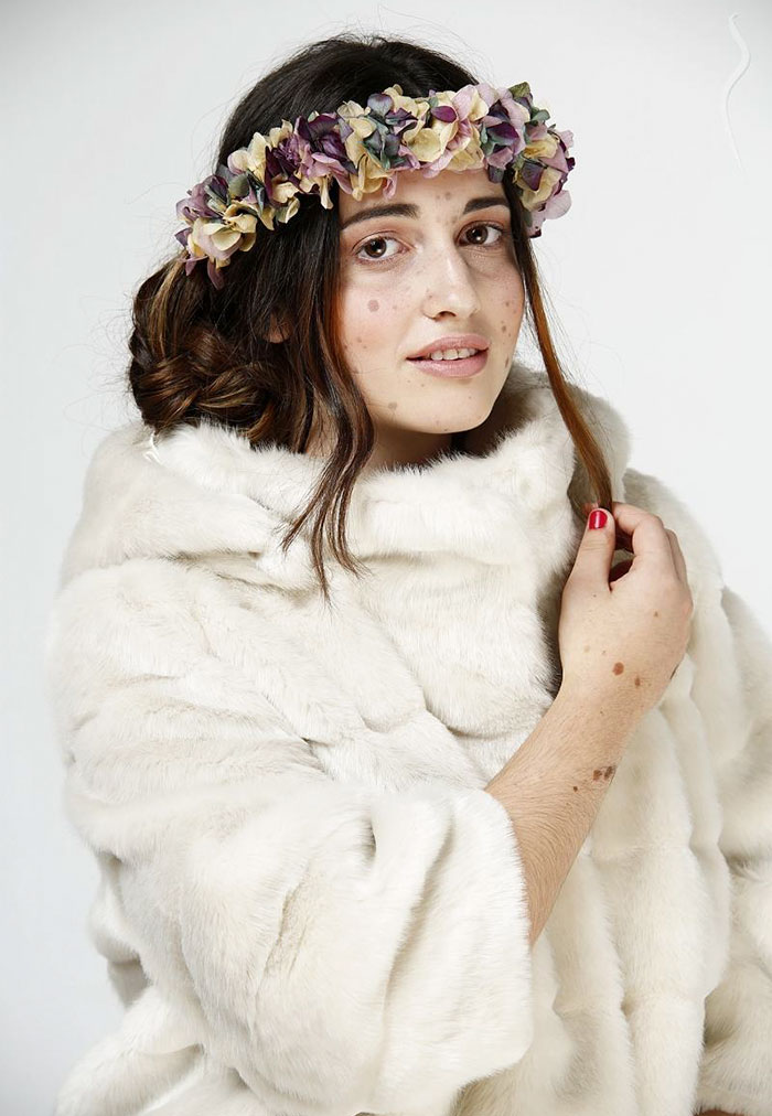 девушка с 500 родинками, Альба Парехо, Alba Parejo