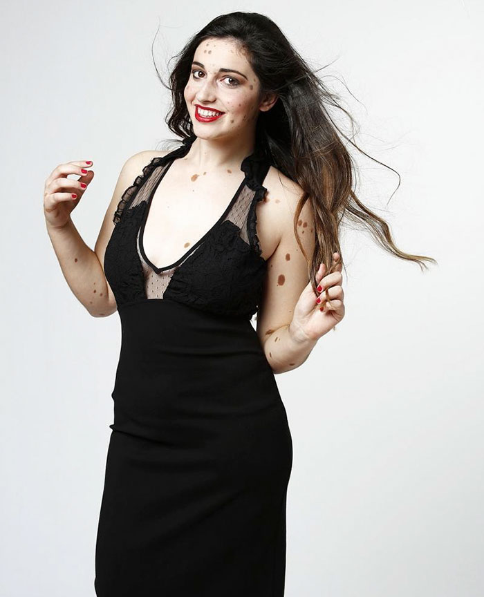 девушка с 500 родинками, Альба Парехо, Alba Parejo