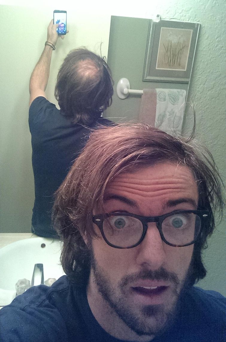 прятать лысину гулька, спрятали облысение гулька