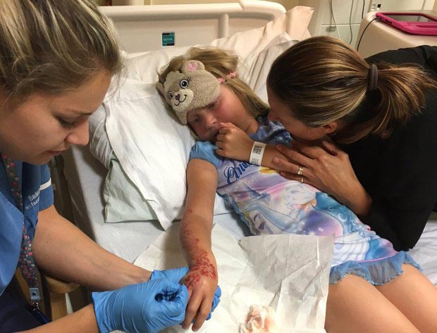 аллергия на хну, аллергия на хну фото, чёрная хна ожоги опасна, чёрная хна ожоги 