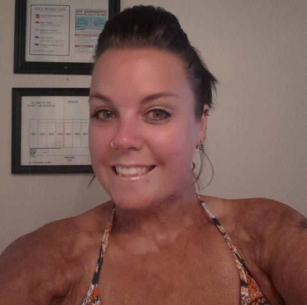 орангутанг видео, орангутанг рассматривает шрамы,