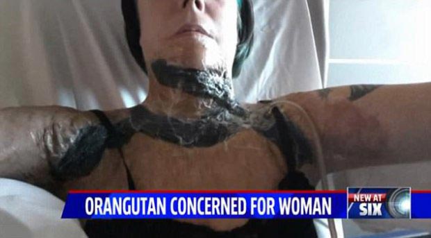 орангутанг видео, орангутанг рассматривает шрамы,