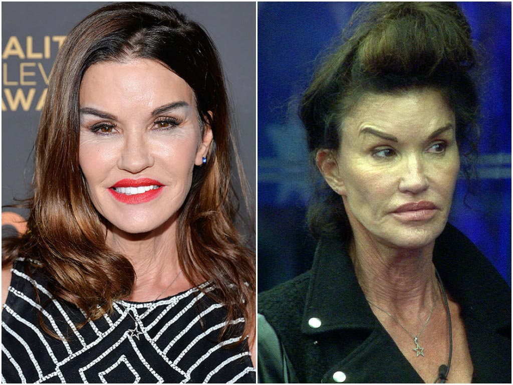 до и после пластических операций, неудачная пластика звёзд