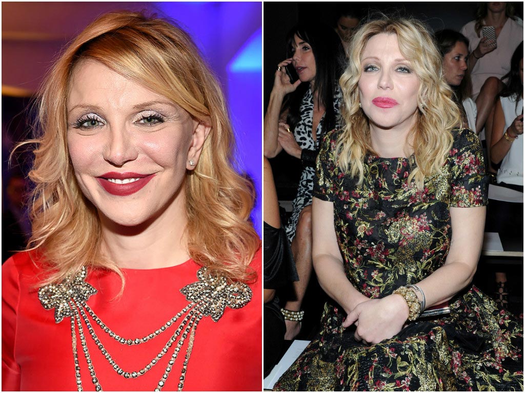 до и после пластических операций, неудачная пластика звёзд