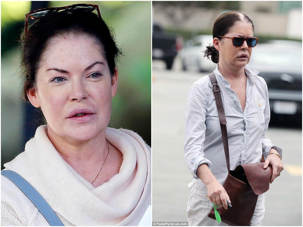 до и после пластических операций, неудачная пластика звёзд