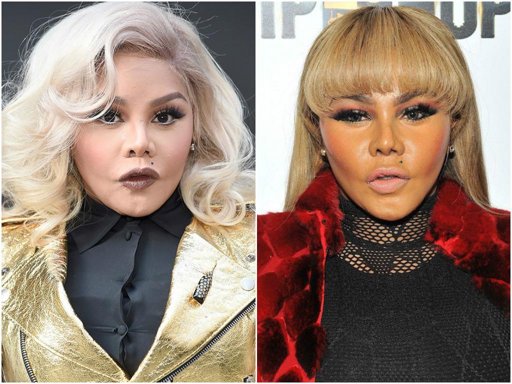 до и после пластических операций, неудачная пластика звёзд