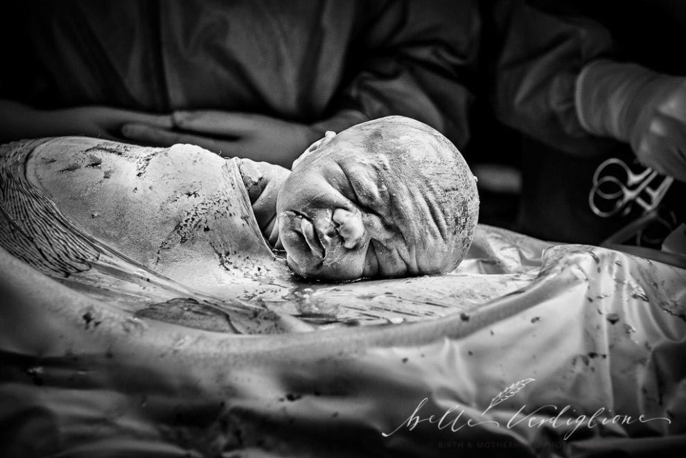 фото с конкурса фотографий родов, Birth Photo Competition 2017, через что проходят мамы, IAPBP