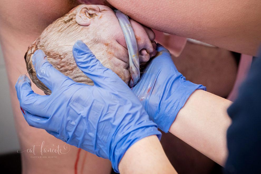 фото с конкурса фотографий родов, Birth Photo Competition 2017, через что проходят мамы, IAPBP