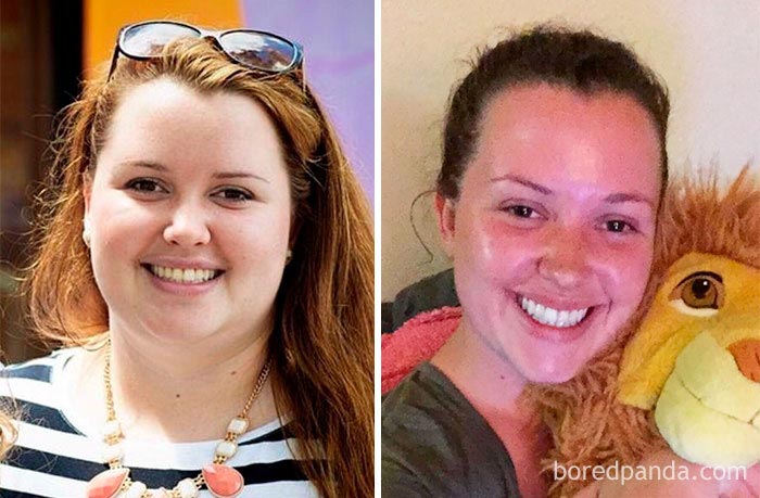 до и после похудения, невероятное похудение