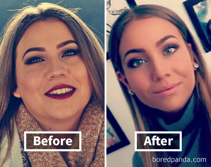 лицо до и после похудения, как меняется лицо после похудения