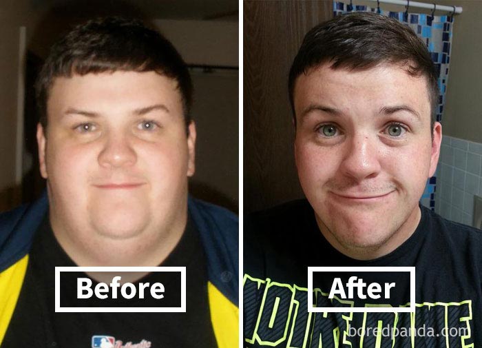 лицо до и после похудения, как меняется лицо после похудения