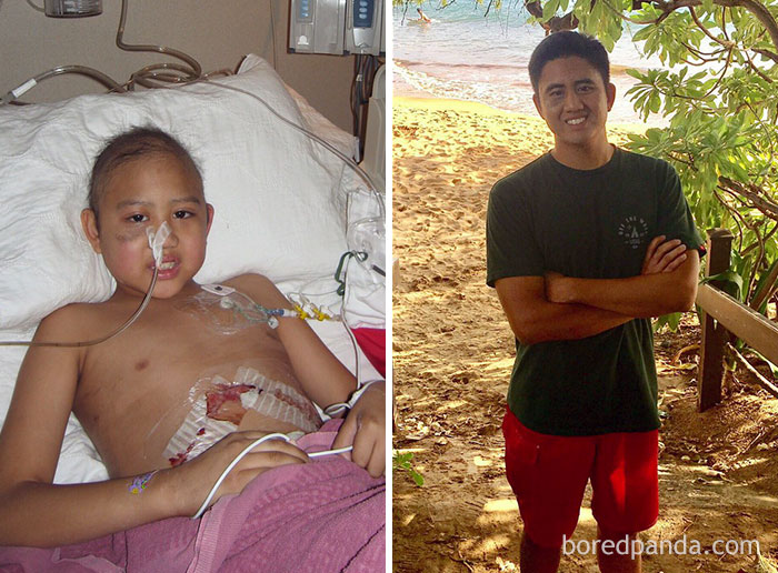 Мощные фотографии людей в стиле ‘до и после’, которые смогли победить рак люди победившие рак, до и после рака