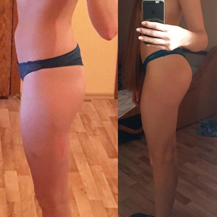 Анастасия Сидорова — русская Рапунцель с роскошными рыжимы волосами, победившая алопецию Анастасия Сидорова, рыжая Рапунцель, русская Рапунцель, длинные рыжие волосы