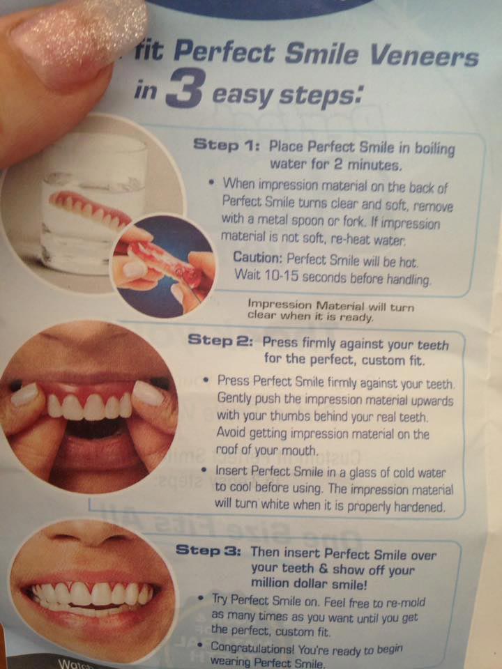 Женщина купила дешёвые готовые виниры, но когда она их надела, у неё началась истерика дешёвые виниры, готовые виниры, женщина купила дешёвые виниры, виниры отзывы