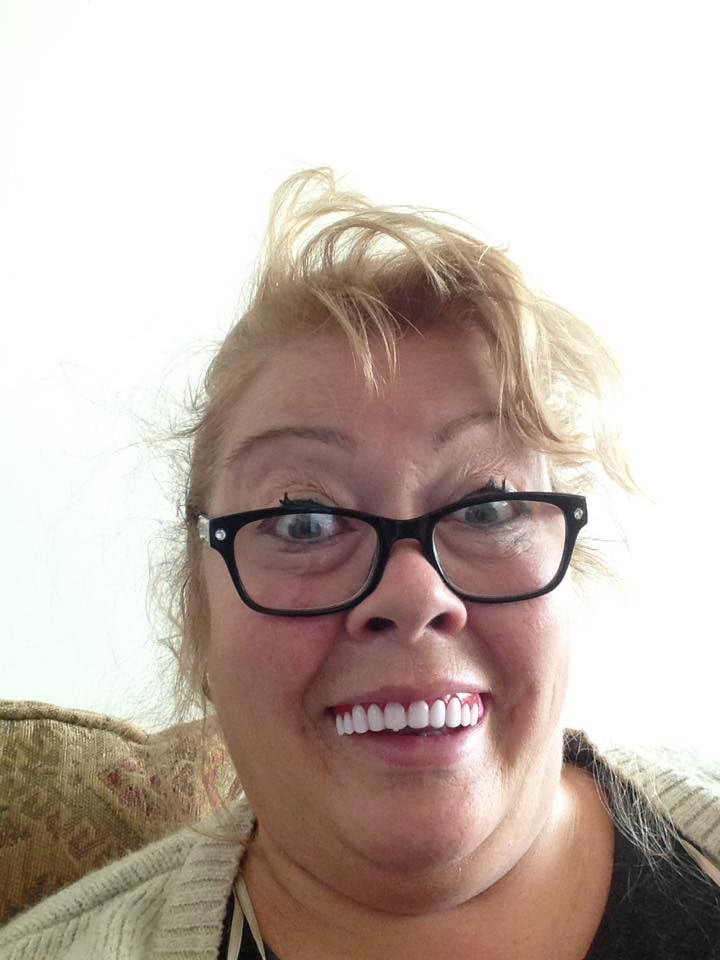 Женщина купила дешёвые готовые виниры, но когда она их надела, у неё началась истерика дешёвые виниры, готовые виниры, женщина купила дешёвые виниры, виниры отзывы