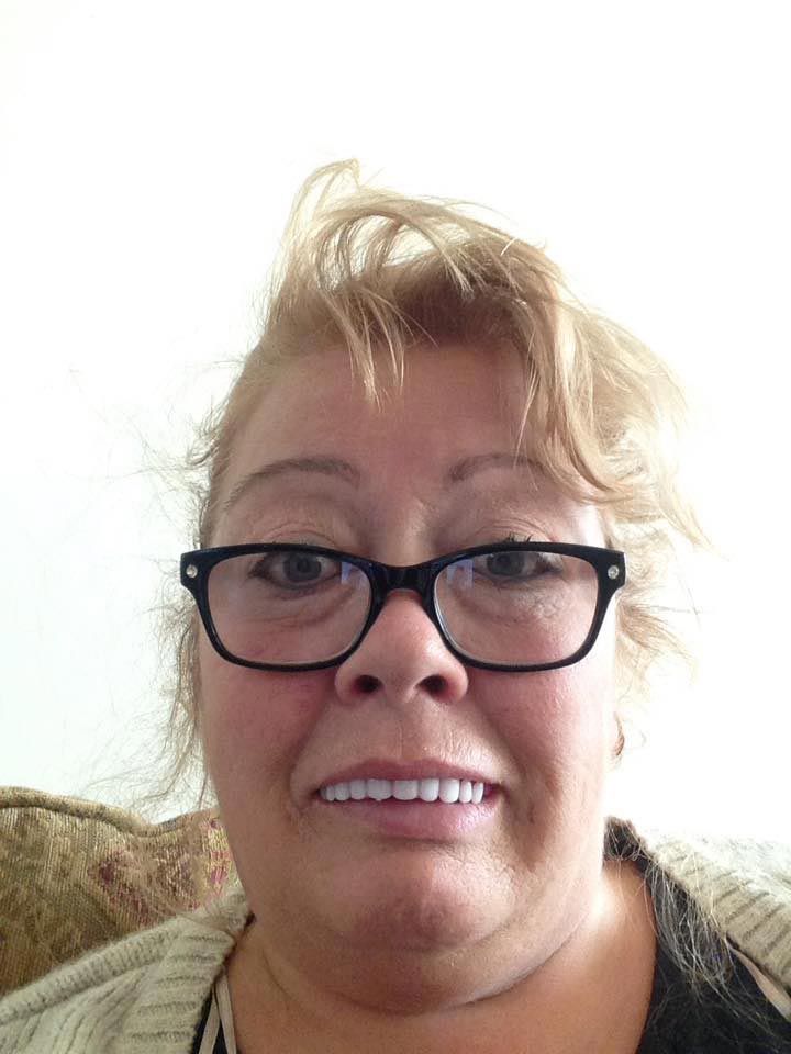 Женщина купила дешёвые готовые виниры, но когда она их надела, у неё началась истерика дешёвые виниры, готовые виниры, женщина купила дешёвые виниры, виниры отзывы