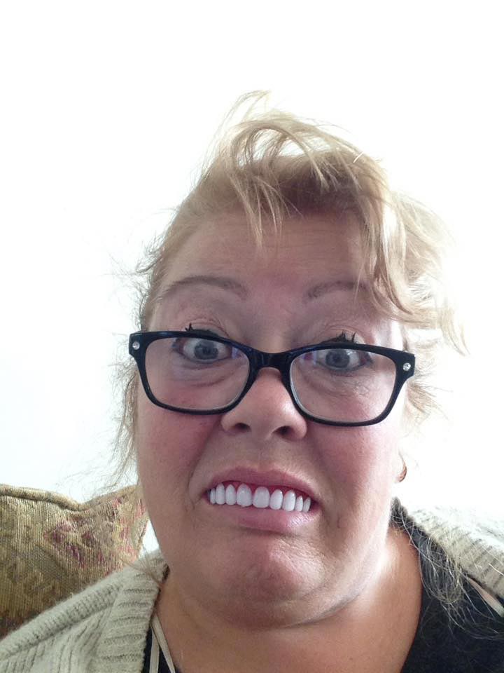 Женщина купила дешёвые готовые виниры, но когда она их надела, у неё началась истерика дешёвые виниры, готовые виниры, женщина купила дешёвые виниры, виниры отзывы