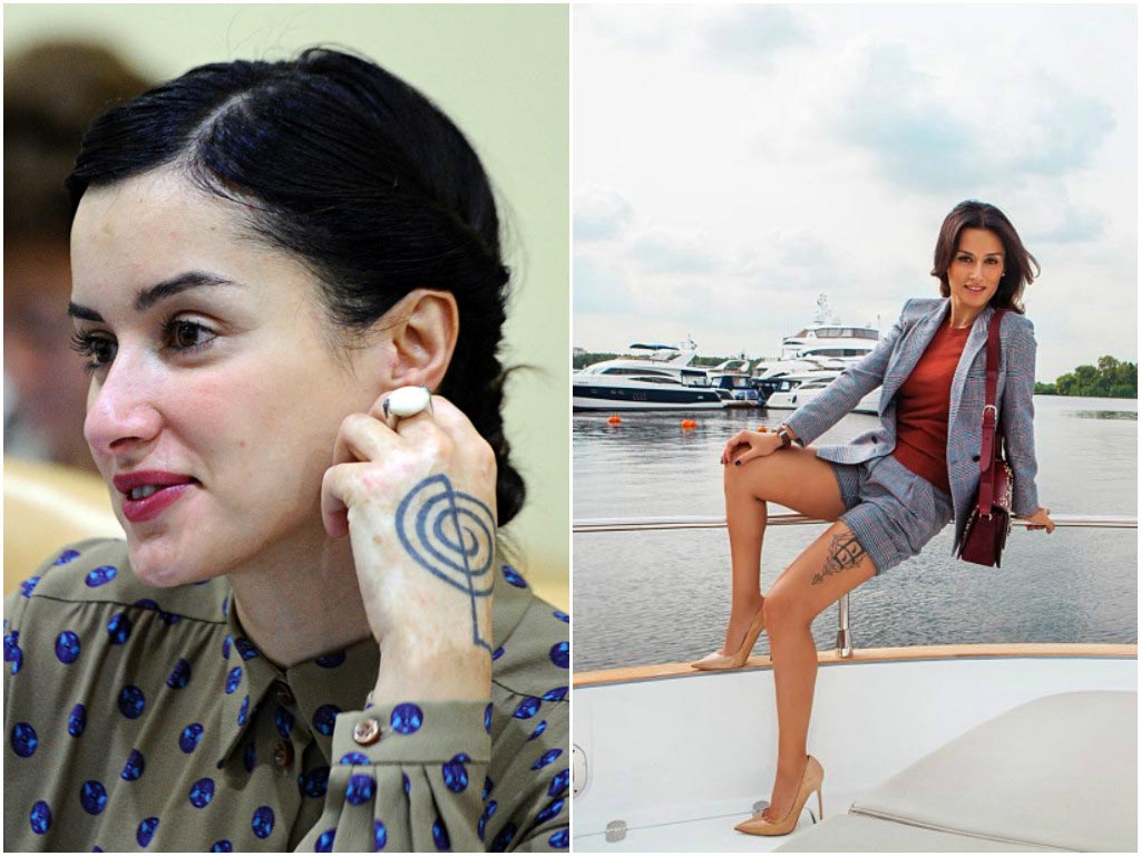 15 жутких и смешных историй о происхождении шрамов звёзд шрамы звёзд, шрамы знаменитостей