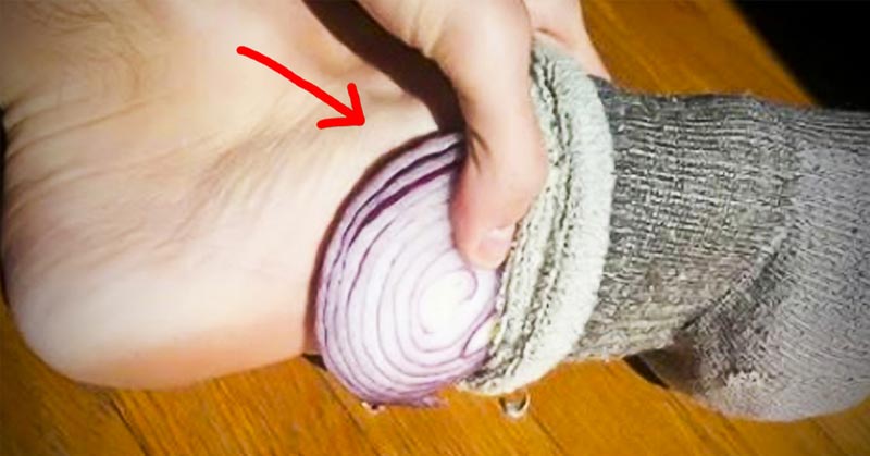 положить в ухо кусочек лука, лук против инфекций, лук в носок