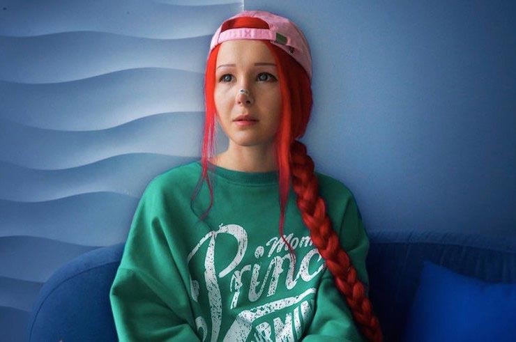 Российские звезды, которым пластические операции вышли боком неудачная пластика звёзд, неудачные пластические операции знаменитостей