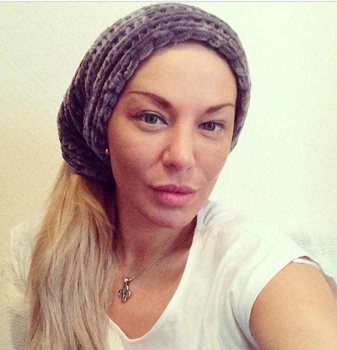 Российские звезды, которым пластические операции вышли боком неудачная пластика звёзд, неудачные пластические операции знаменитостей