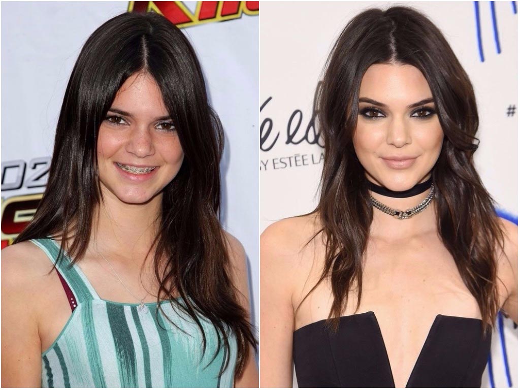 модели  в юности, известные модели в молодости и сейчас