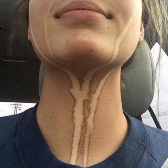 случаи с автозагаром, неудачное использование автозагара