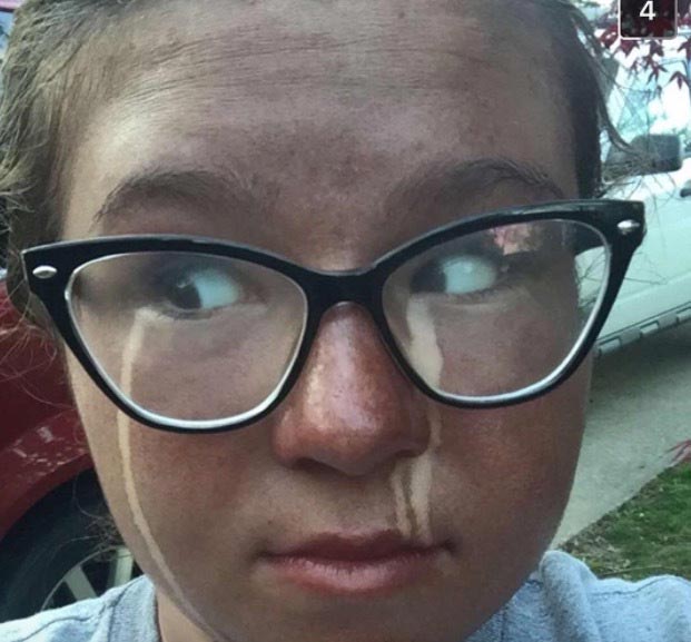 случаи с автозагаром, неудачное использование автозагара