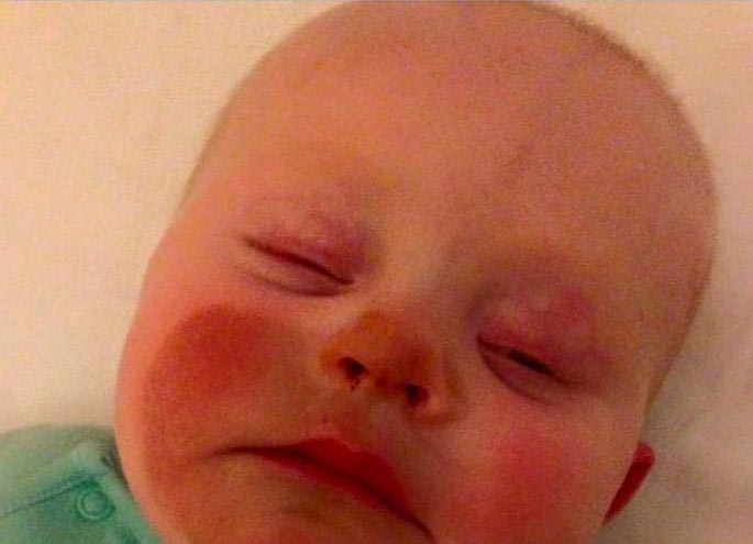 случаи с автозагаром, неудачное использование автозагара