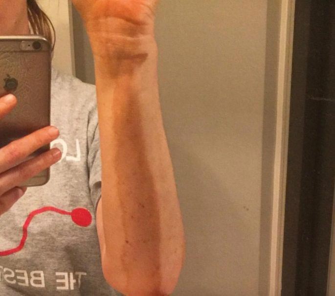 случаи с автозагаром, неудачное использование автозагара