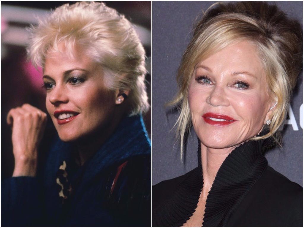 неудачная ринопластика звёзд, неудачные пластические операции 