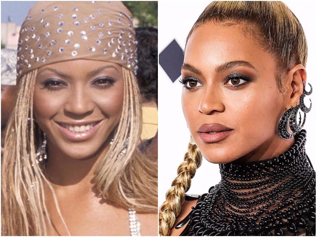 неудачная ринопластика звёзд, неудачные пластические операции 