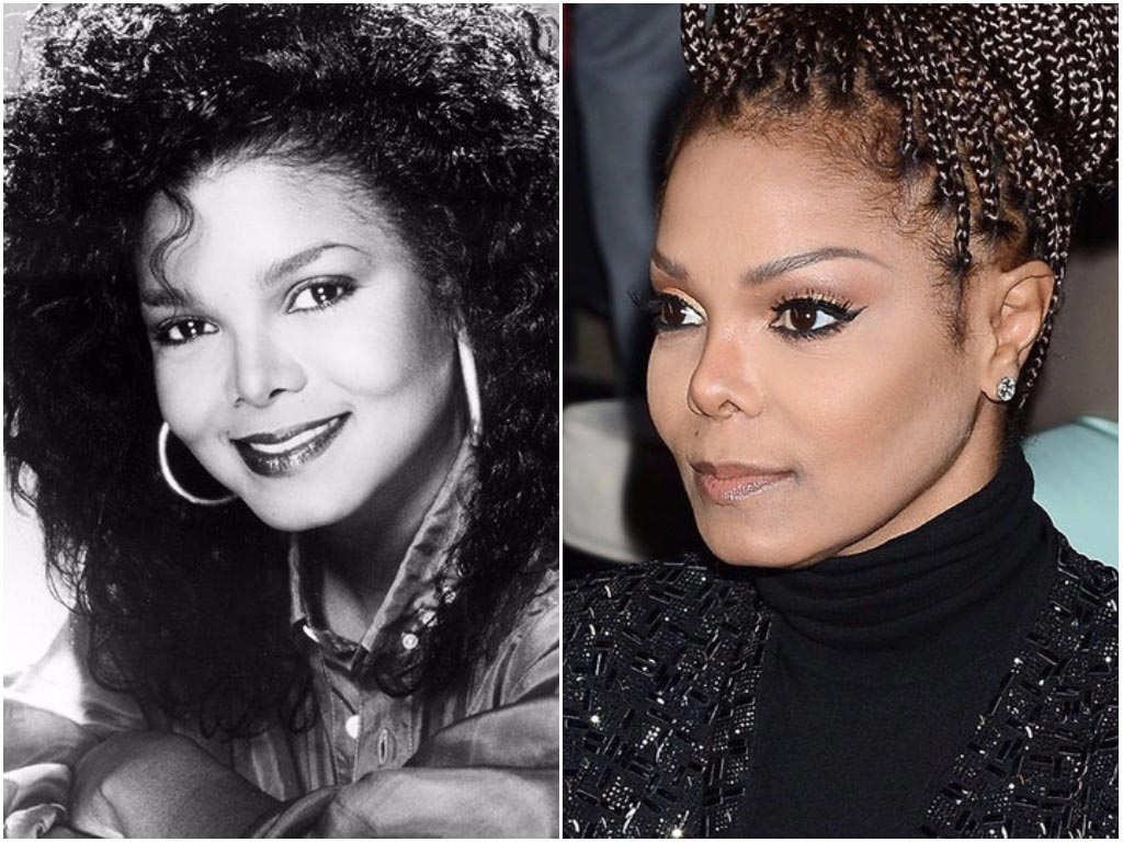 неудачная ринопластика звёзд, неудачные пластические операции 