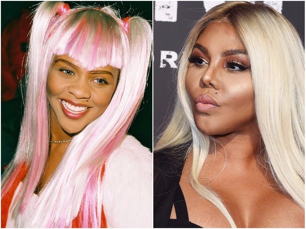 неудачная ринопластика звёзд, неудачные пластические операции 