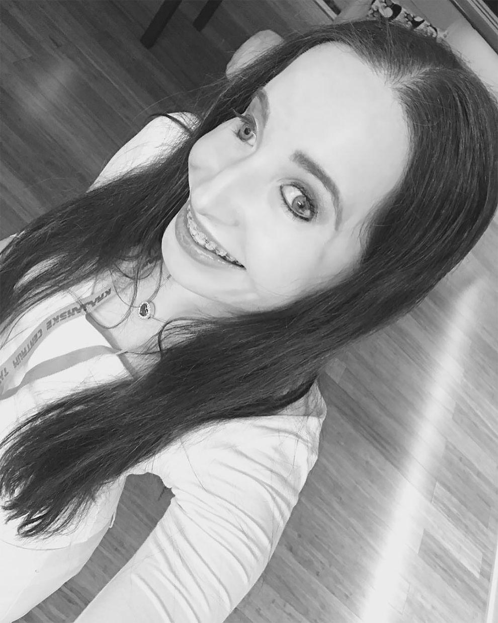 Иванка Данисова, родилась с половиной лица, родилась с красивой половиной лица