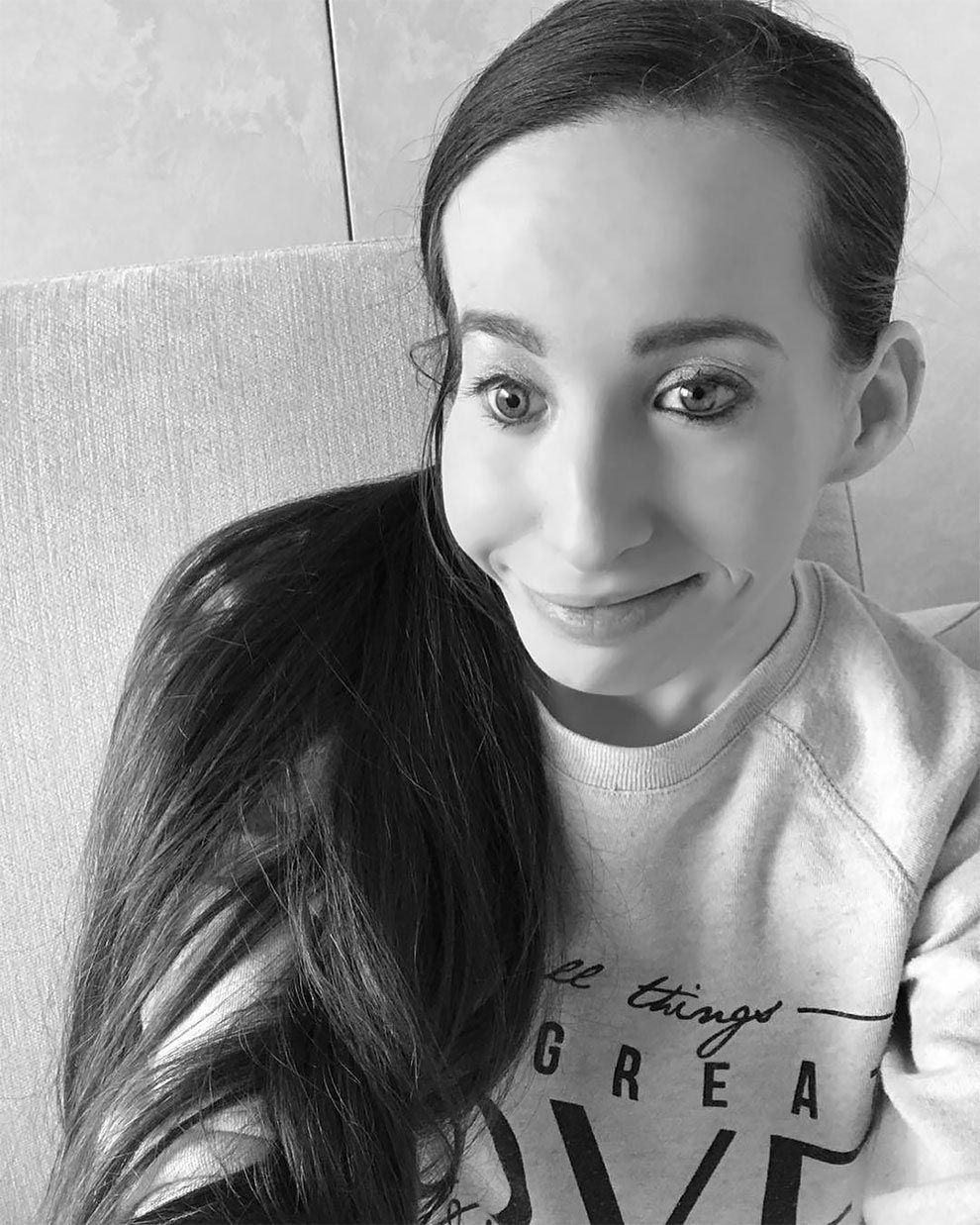 Иванка Данисова, родилась с половиной лица, родилась с красивой половиной лица