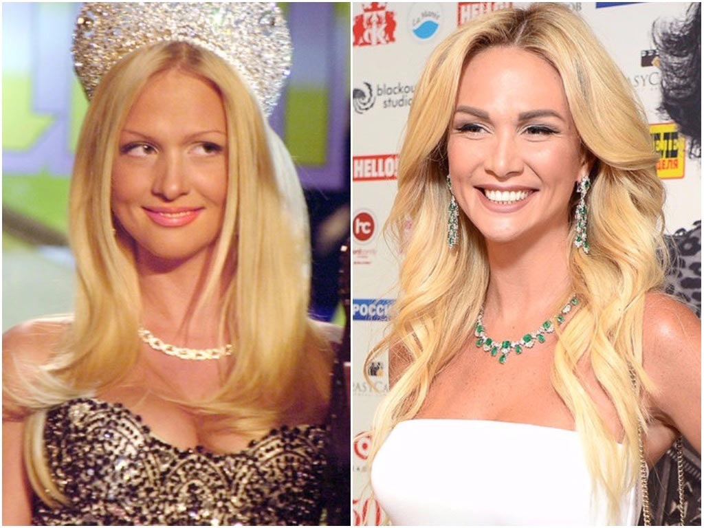 Как изменились лица звёзд до и после пластических операций, звёзды до и после пластических операций