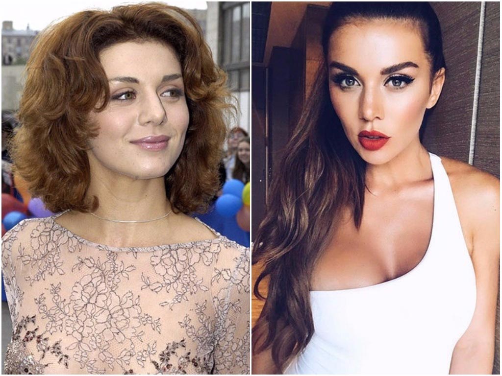 Как изменились лица звёзд до и после пластических операций, звёзды до и после пластических операций