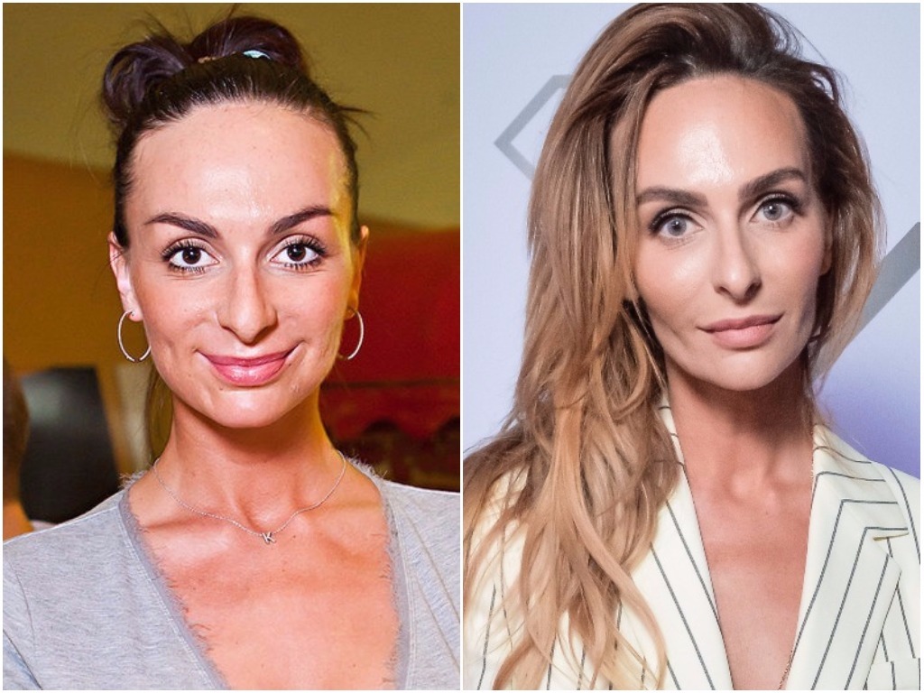 Екатерина вилкова пластика лица до и после фото