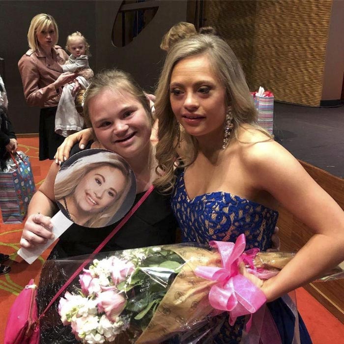 Микайлы Холмгрен, Mikayla Holmgren, первая женщина с синдромом Дауна ставшая победительницей на конкурсе красоты