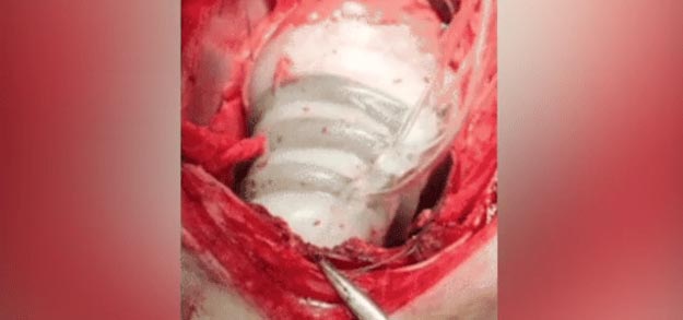 изобретения 2017 года, полезные изобретения 