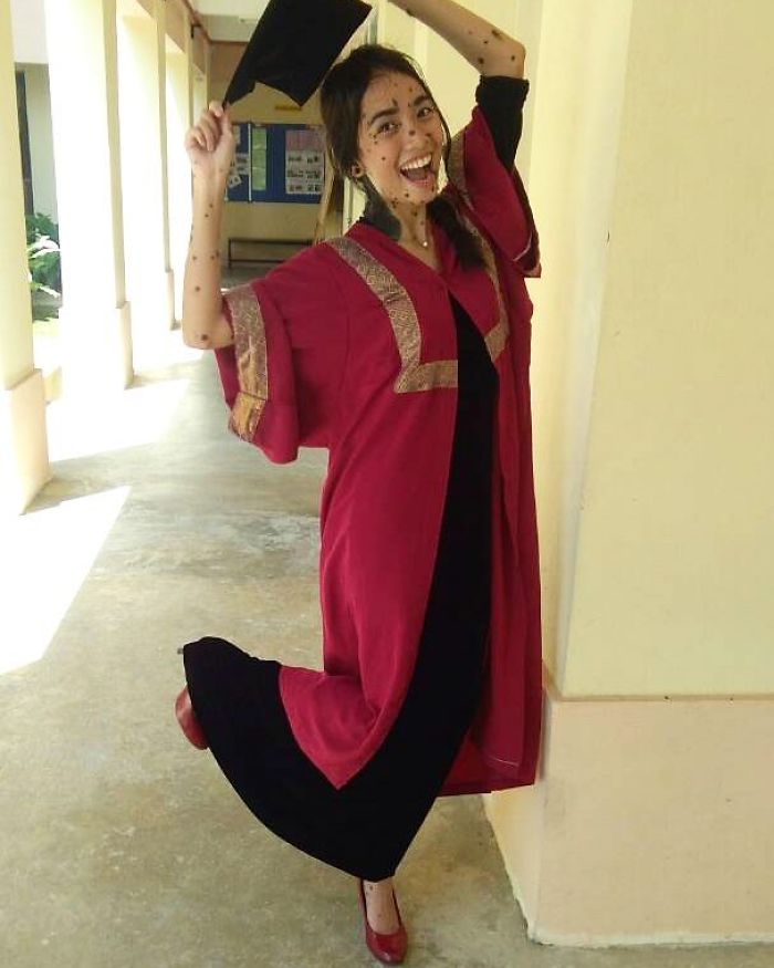 Эвита Патси Эдгар Делмундо, девушка с родинками на лице и теле