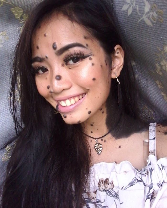 Эвита Патси Эдгар Делмундо, девушка с родинками на лице и теле