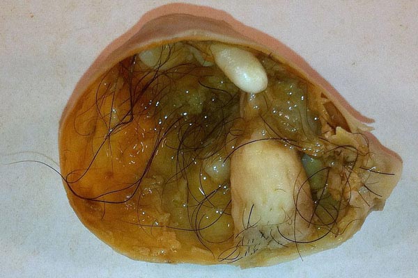 шокирующие факты о человеческом теле, факты о нашем теле