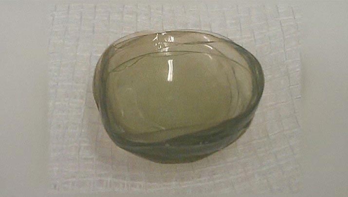 Самые интересные медицинские истории 2017 года, медицинские истории 2017 года