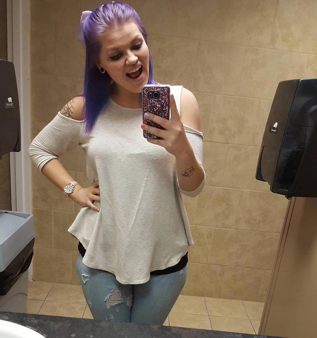 огромное количество лишней кожи, лишняя кожа после похудения, Кайла Батчер, Kayla Butcher)