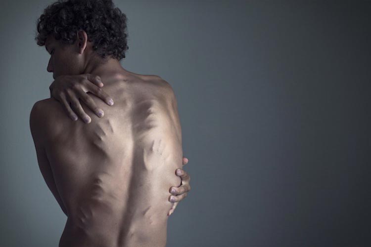 депрессия в фотографиях, фотографы показали свою депрессию