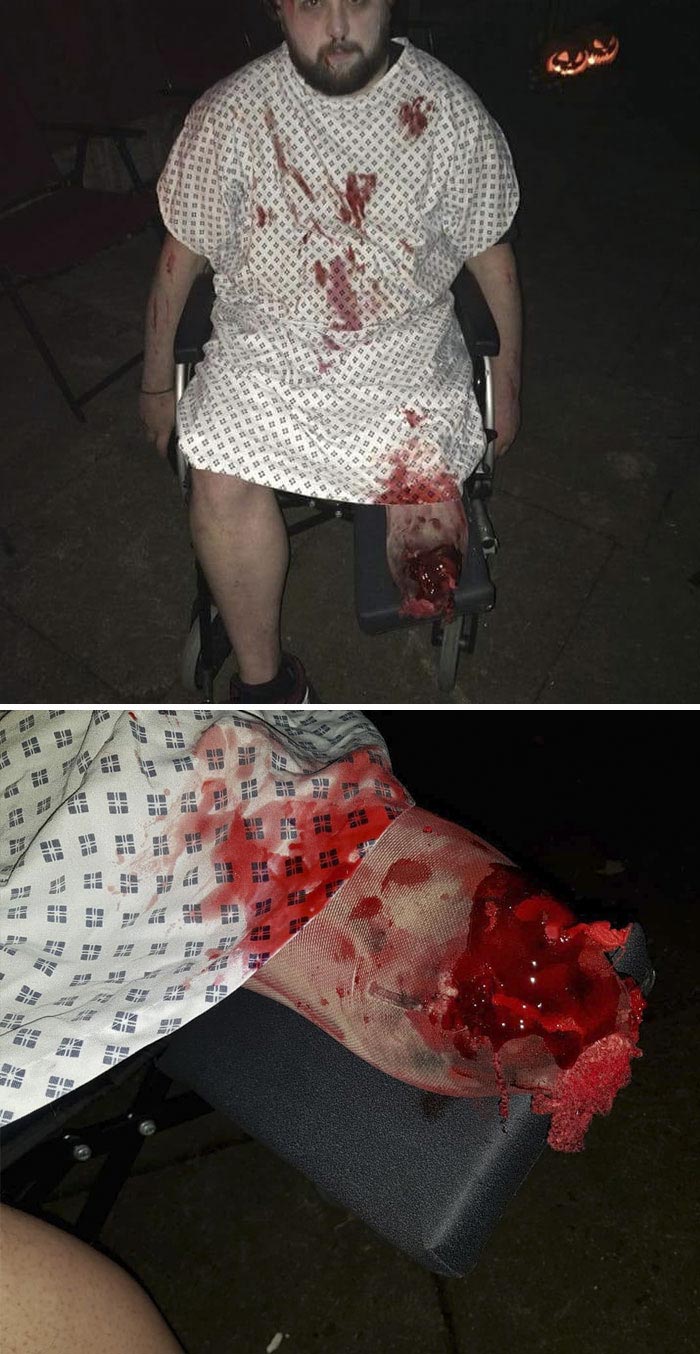 костюмы для инвалидов на Хэллоуин, люди с ограниченными возможностям в костюмах на Хэллоуин 