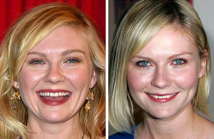 звёзды которые принимают себя такими какие они есть, звёзды против пластики 