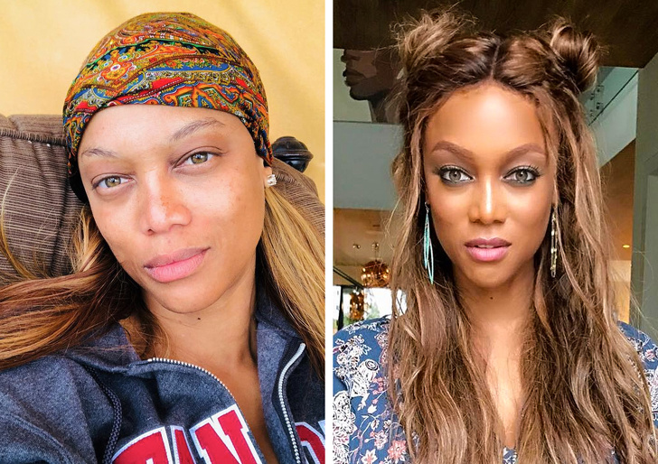 звёзды которые принимают себя такими какие они есть, звёзды против пластики 